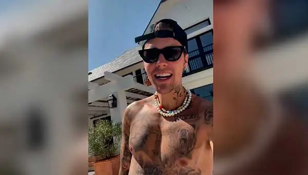 Justin Bieber reaparece luego de haber sufrido una parálisis facial