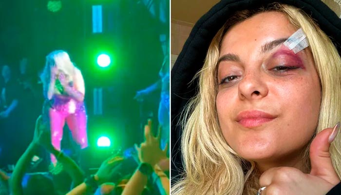 Conmoción en el concierto de Bebe Rexha: Fan lesiona a la cantante al lanzarle su celular